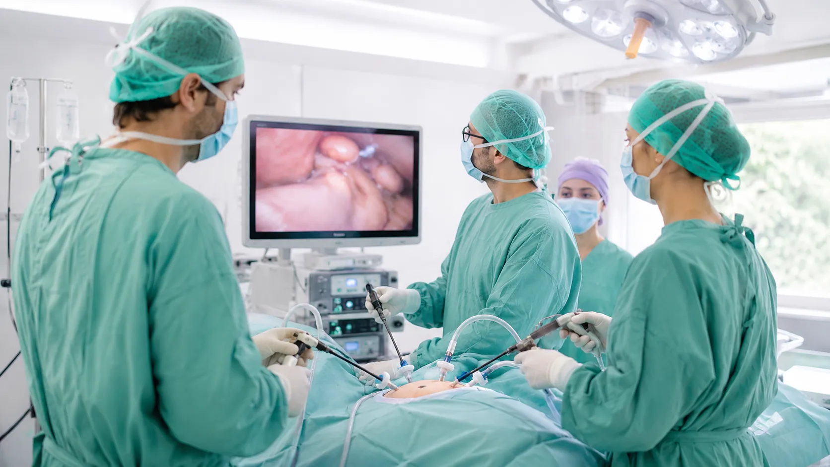 Hepatectomía